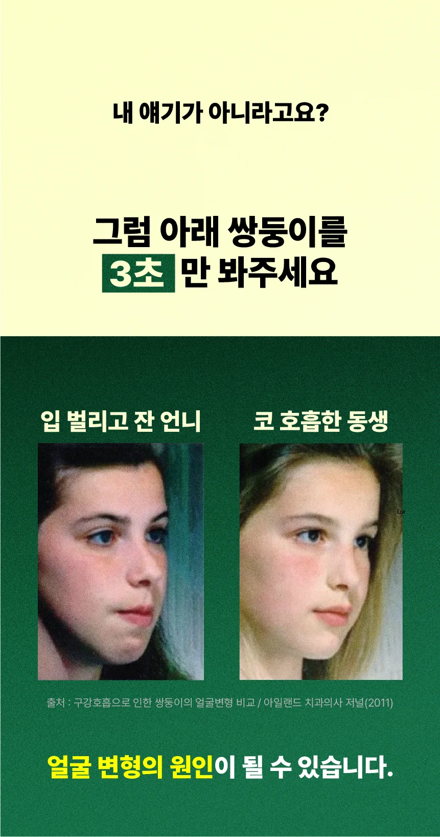 식빵밴드 입벌림방지밴드 상세 3